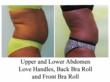 Preparing for Growth, Liposuction Specialist, MyShape Lipo Launches...
